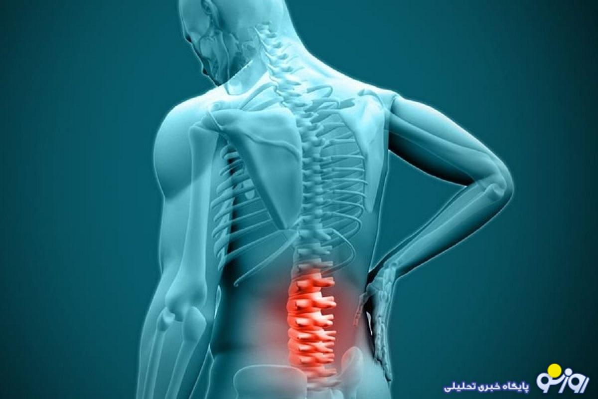 دیسک کمر چیست و چگونه بر زندگی افراد تأثیر میگذارد؟ دیسک کمر چیست و چگونه بر زندگی افراد تأثیر میگذارد؟
